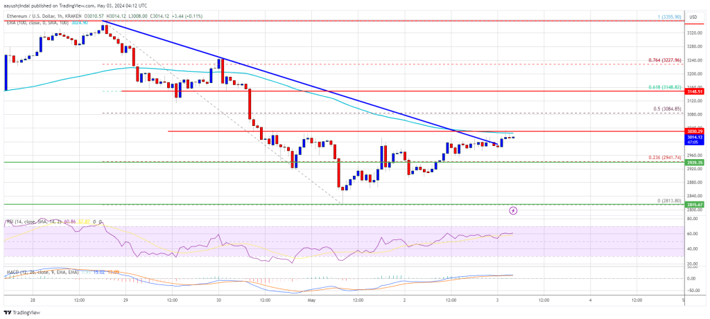 Цена Ethereum может вырасти, если он сможет восстановить 100 SMA