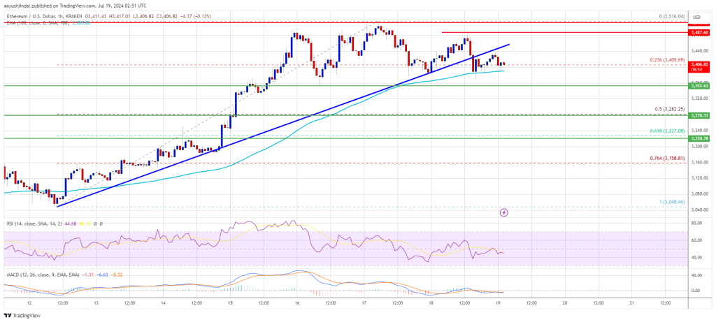 Ethereum Price Pulls Back: ETH Gains Under Pressure