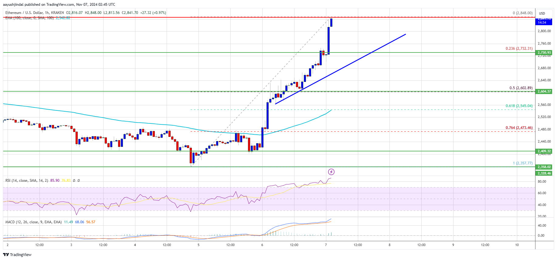 Ethereum-Preis steigt um 10 %: Werden die Bullen ihn nach oben treiben?